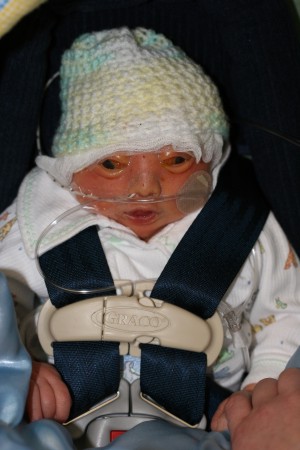 Isaac Ayden, baby with anencephaly