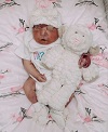 Heavenly Ann, baby with anencephaly
