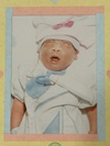 Jesica Lynne, baby with anencephaly