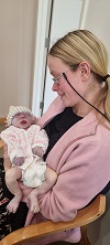 Stephanie Grace, baby with anencephaly